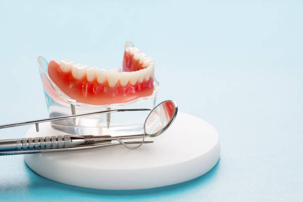 Best Dental Implants  in Parkwood, WA